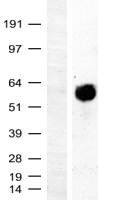 c-Myc (MYC) Human Over-expression Lysates NM_002467
