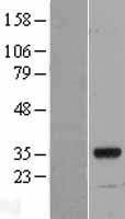 MYF6 Human Over-expression Lysates NM_002469
