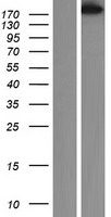 smooth muscle Myosin heavy chain 11 (MYH11) Human Over-expression Lysates NM_001040114