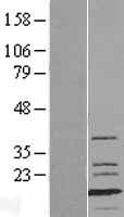 myosin light chain 1 (MYL1) Human Over-expression Lysates NM_079422