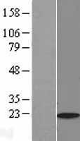 Myosin Light Chain 2 (MYL2) Human Over-expression Lysates NM_000432