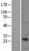 Myosin light chain 3 (MYL3) Human Over-expression Lysates NM_000258