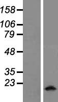 Myosin (MYL5) Human Over-expression Lysates NM_002477