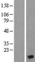 Myosin (MYL6) Human Over-expression Lysates NM_021019