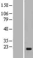 Myosin light chain kinase (MYLK) Human Over-expression Lysates NM_053031
