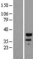 MYOD1 Human Over-expression Lysates NM_002478
