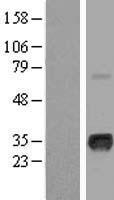 Myogenin (MYOG) Human Over-expression Lysates NM_002479