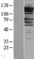 Myosin Phosphatase (PPP1R12A) Human Over-expression Lysates NM_002480