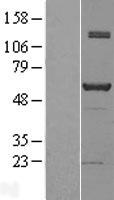 NAB1 Human Over-expression Lysates NM_005966