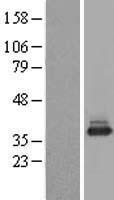 ls004666 naca human over expression lysates nm 001113202 wb testing 3