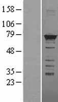 HNRPM (HNRNPM) Human Over-expression Lysates NM_031203