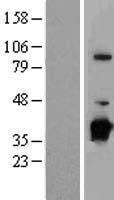 NUBP1 Human Over-expression Lysates NM_002484