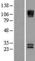 CD56 (NCAM1) Human Over-expression Lysates NM_181351