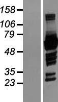NCF2 Human Over-expression Lysates NM_001127651
