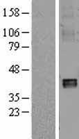 NDUFA10 Human Over-expression Lysates NM_004544