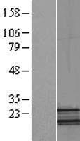 NDUFB5 Human Over-expression Lysates NM_002492