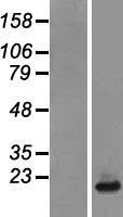 NDUFB6 Human Over-expression Lysates NM_002493