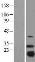 NDUFB7 Human Over-expression Lysates NM_004146