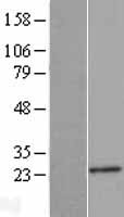 ls004715 ndufb9 human over expression lysates nm 005005 wb testing 1