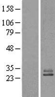 NDUFS3 Human Over-expression Lysates NM_004551