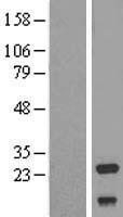 NDUFV2 Human Over-expression Lysates NM_021074