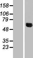 NDUFV3 Human Over-expression Lysates NM_021075