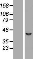 Septin 2 (SEPT2) Human Over-expression Lysates NM_001008492