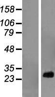 RPL10A Human Over-expression Lysates NM_007104