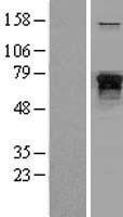 Neurofilament (NEFL) Human Over-expression Lysates NM_006158