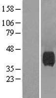 ls004758 neuraminidase neu1 human over expression lysates nm 000434 wb testing 1