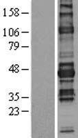 NFAT2 (NFATC1) Human Over-expression Lysates NM_172388