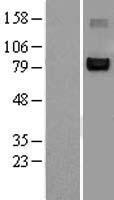 NFAT2 (NFATC1) Human Over-expression Lysates NM_172390
