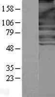 NFkB p100 / p52 (NFKB2) Human Over-expression Lysates NM_001077493