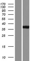 IKB beta (NFKBIB) Human Over-expression Lysates NM_001001716