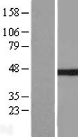 IKB beta (NFKBIB) Human Over-expression Lysates NM_002503