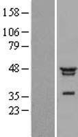 NFKBIL1 Human Over-expression Lysates NM_005007