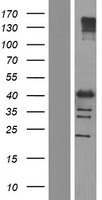 ls004802 nfyc human over expression lysates nm 001142588 wb testing 1