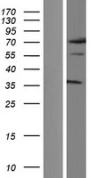 ls004802 nfyc human over expression lysates nm 001142589 wb testing 4