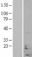 NHLH1 Human Over-expression Lysates NM_005598