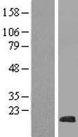 NHLH2 Human Over-expression Lysates NM_001111061