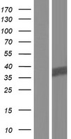 ls004817 nit1 human over expression lysates nm 001185092 wb testing 1