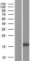 ls004828 neuromedin b nmb human over expression lysates nm 021077 wb testing 1