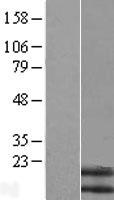 ls004828 neuromedin b nmb human over expression lysates nm 205858 wb testing 2