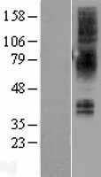 NMBR Human Over-expression Lysates NM_002511