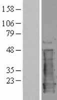 NM23A (NME1) Human Over-expression Lysates NM_000269