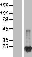 NM23A (NME1) Human Over-expression Lysates NM_198175