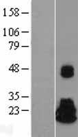 NME4 Human Over-expression Lysates NM_005009