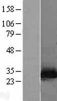 NNMT Human Over-expression Lysates NM_006169