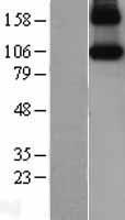 iNOS (NOS2) Human Over-expression Lysates NM_000625