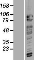 CCR4 NOT transcription complex subunit 3 (CNOT3) Human Over-expression Lysates NM_014516